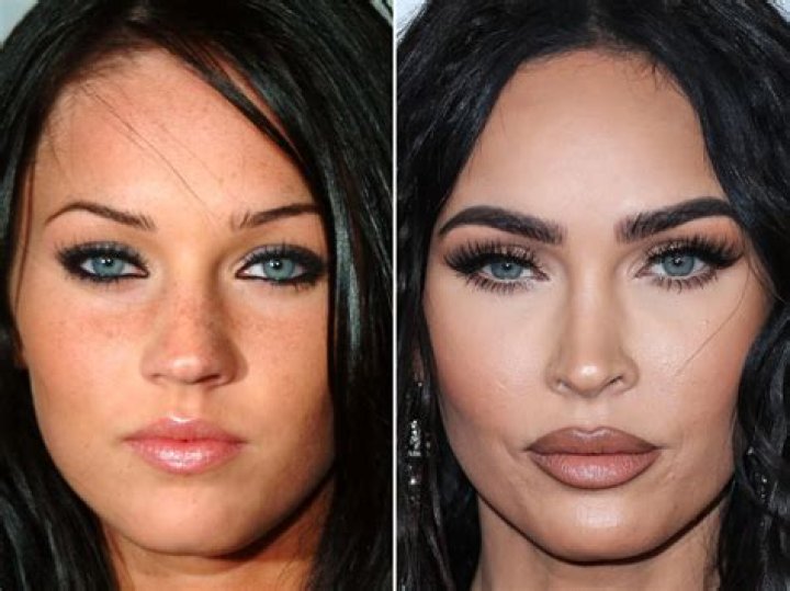 Unveiling The Secrets Of Megan Fox's Finger Condition: Discoveries And Insights
