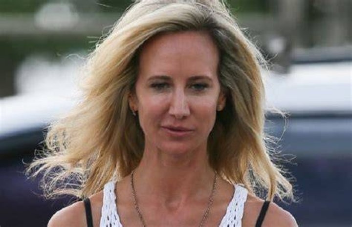 What Happened to Lady Victoria Hervey’s Face?