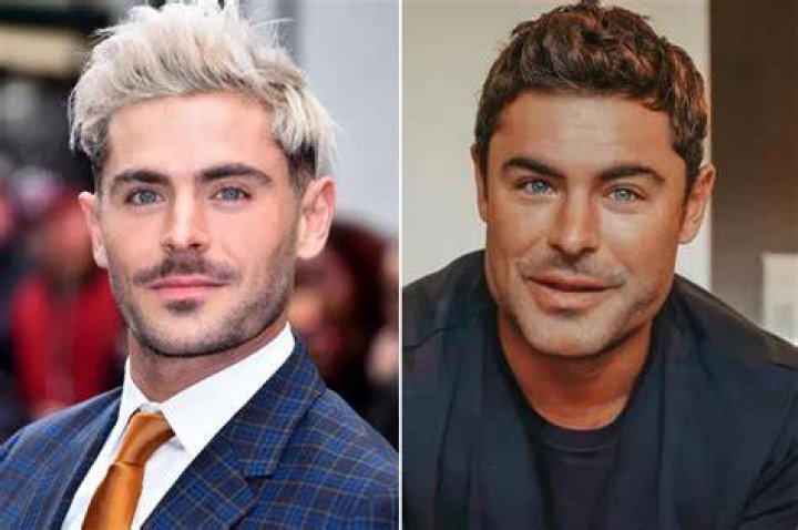 Zac Efron Botox And Jaw Surgery Before